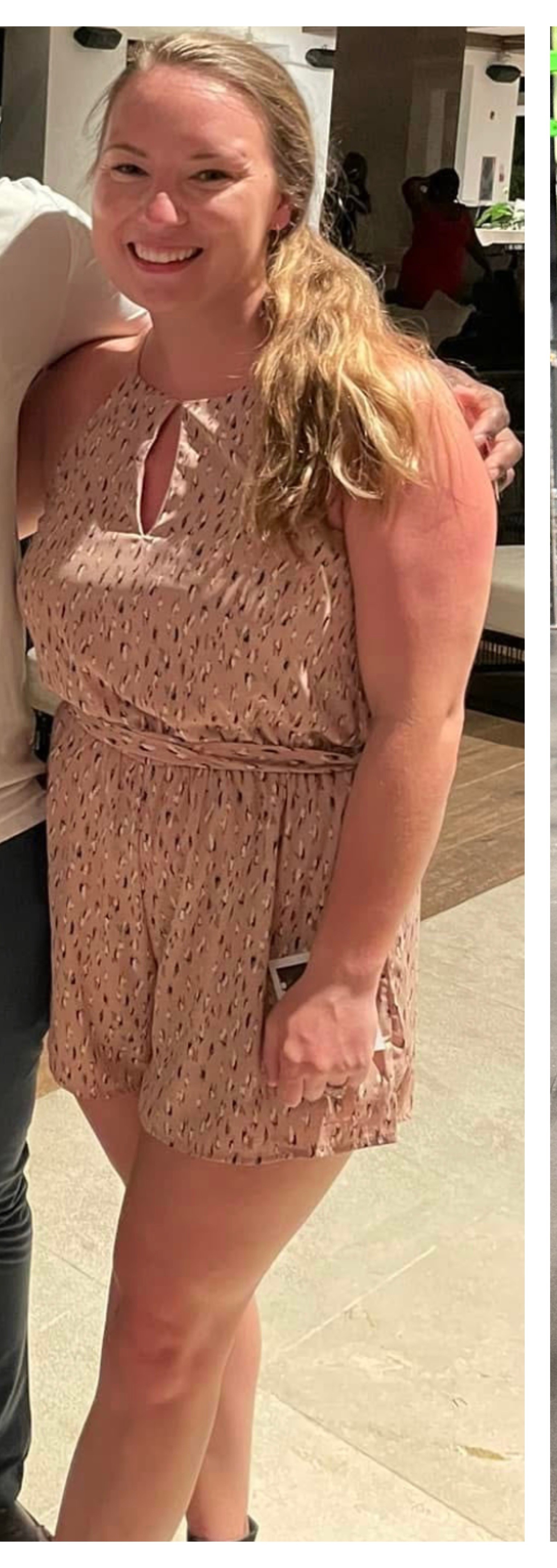 Keri Echols Before
